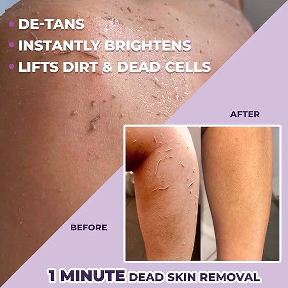 Tan & Dead Skin Removal Exfoliating Gel