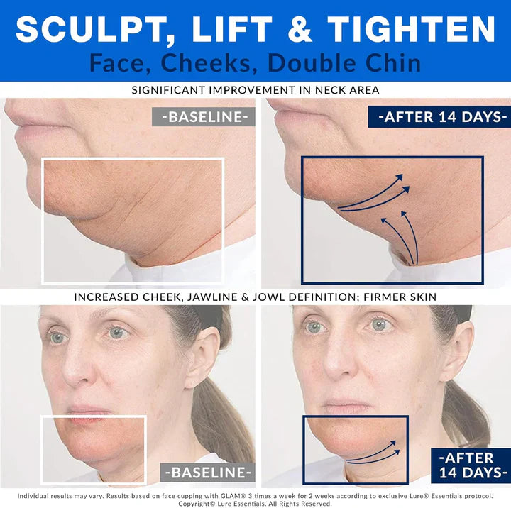 Facial Cupping Set for Skin Uplifting and tightning